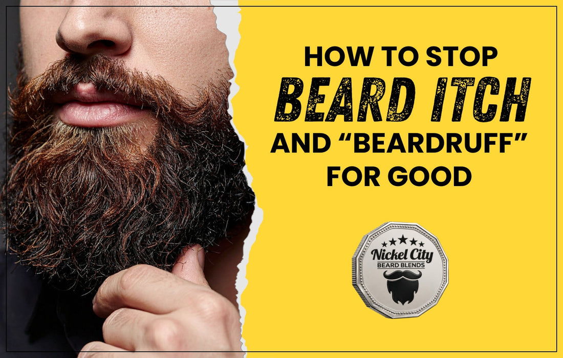 Blog: How to stop beard itch and beardruff